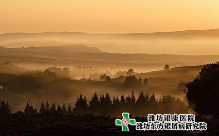 冬天牛皮癬為什么會復發?誘發因素有哪些?