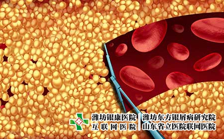 攝圖網_300850448_除膽固醇清潔動脈的醫學,如刮水器,清除堵塞動脈中的斑塊,動脈粥樣硬化疾病醫院治療的象征,打開堵塞的靜脈三維插（企業商用）