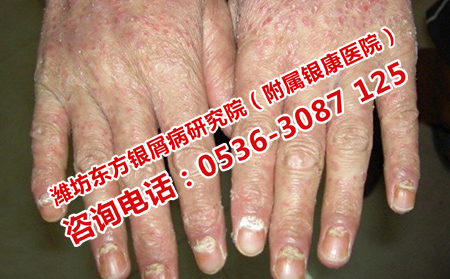濰坊銀康醫(yī)院電話